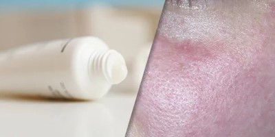 Ivermectin Cream | Shaanxi BLOOM Tech Co., Ltd Ivermectin Cream | Shaanxi BLOOM Tech Co., Ltd